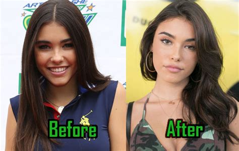 does madison beer have a boob job|The Truth About Madison Beers Plastic Surgery Rumors